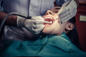 do you need a dental crown after a root canal