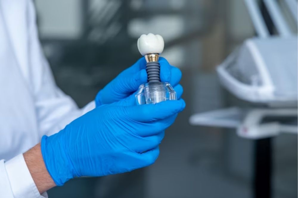 How Dental Implants Can Improve Your Quality Of Life